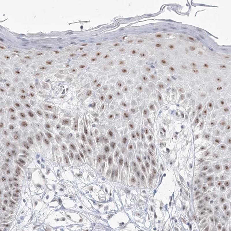 Staining of human vulva/anal skin shows moderate nucleolar positivity in squamous epithelial cells.