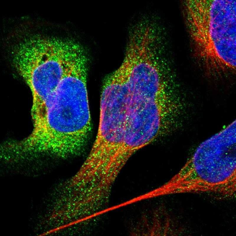 Staining of human cell line U-2 OS shows localization to cytosol.