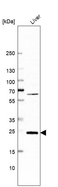 Analysis in human liver tissue.