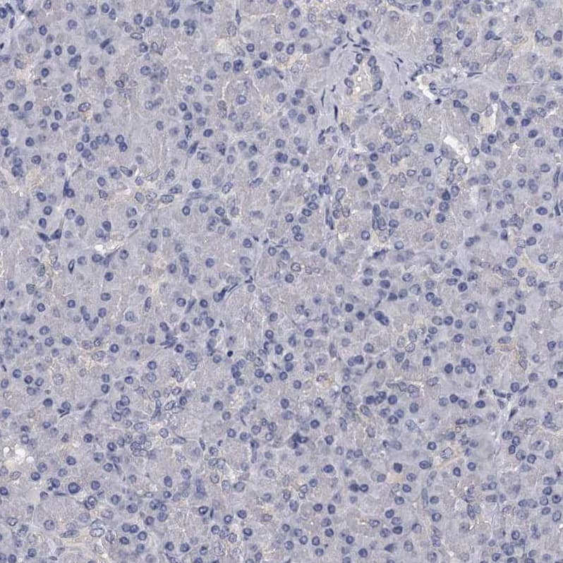 Staining of human pancreas shows no positivity in exocrine glandular cells as expected.