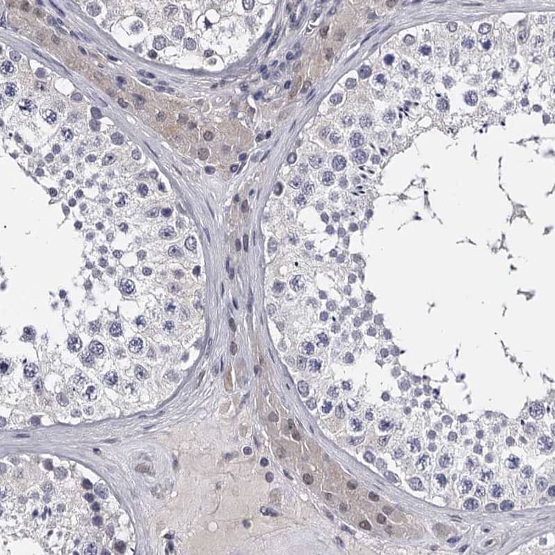 Staining of human testis shows weak cytoplasmic positivity in Leydig cells as expected.