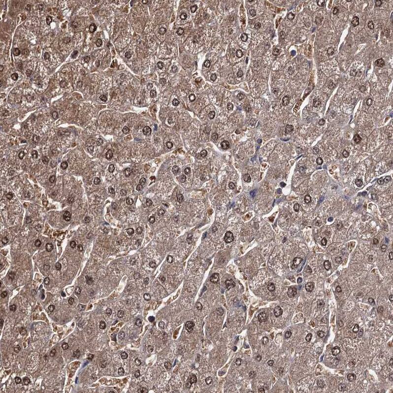 Staining of human liver shows strong cytoplasmic and nuclear positivity in hepatocytes.
