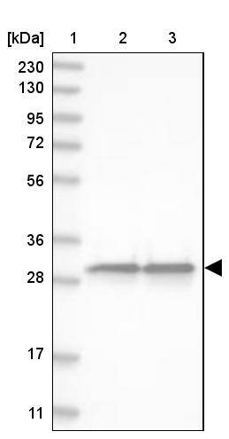 Lane 1: Marker [kDa] 230, 130, 95, 72, 56, 36, 28, 17, 11Lane 2: Human cell line RT-4Lane 3: Human cell line U-251MG sp