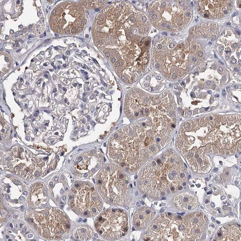 Staining of human kidney shows moderate cytoplasmic positivity in cells) in tubules.