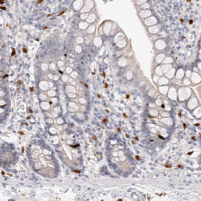 Staining of human small intestine shows strong cytoplasmic positivity in lymphoid cells.