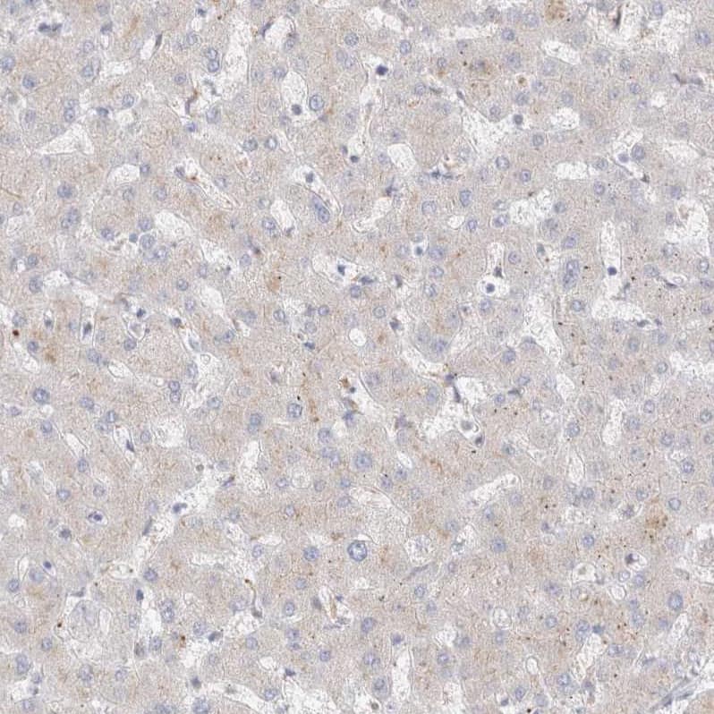 Staining of human liver shows no positivity in hepatocytes as expected.