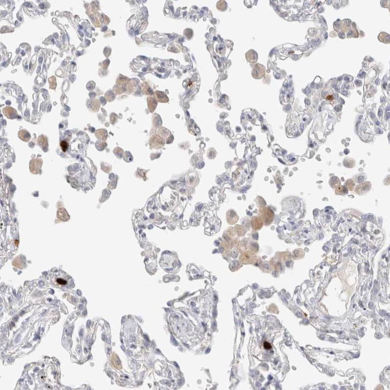 Staining of human lung shows weak to moderate cytoplasmic positivity in macrophages.