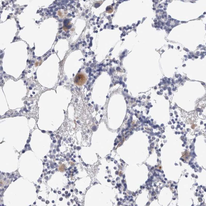 Staining of human bone marrow shows moderate cytoplasmic positivity in megakaryocytes.