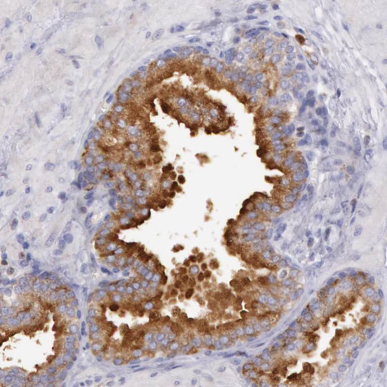 Staining of human prostate shows strong cytoplasmic positivity in glandular cells.