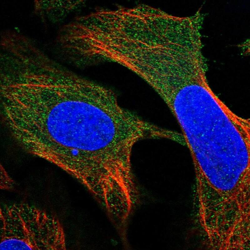 Staining of human cell line U-2 OS shows localization to cytosol.