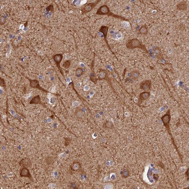 Staining of human cerebral cortex shows strong cytoplasmic positivity in neuronal cell.