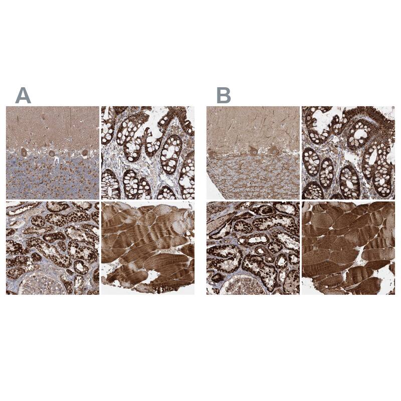 <b>Independent Antibodies Validation. </b>Staining of human cerebellum, gastrointestinal, kidney and skeletal muscle using Anti-LRPPRC antibody NBP1-83349 (A) shows similar protein distribution across tissues to independent antibody NBP2-38300 (B).