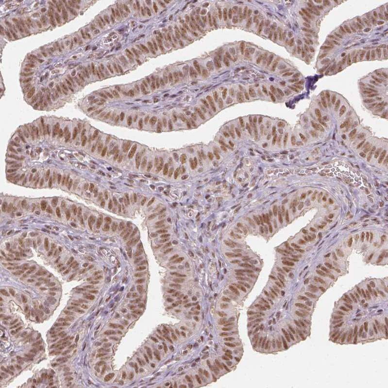 Staining of human fallopian tube shows moderate nuclear positivity in glandular cells.