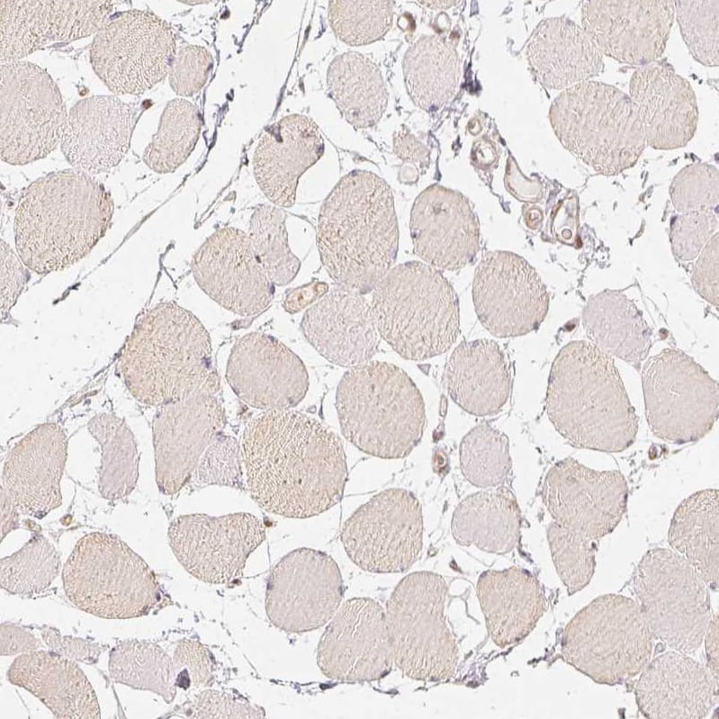 Staining of human skeletal muscle shows no positivity in myocytes as expected.