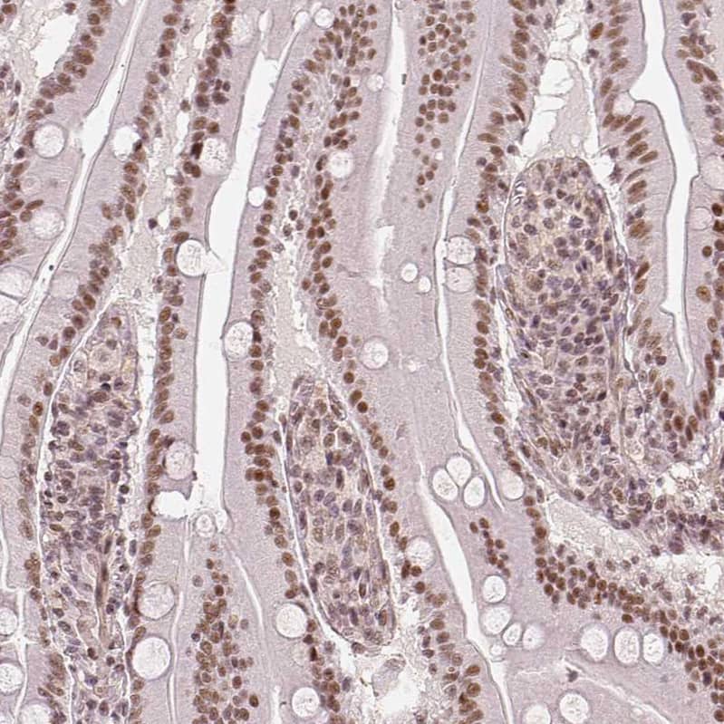 Staining of human small intestine shows moderate nuclear positivity in glandular cells.