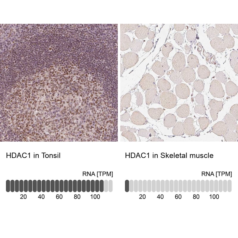 <b>Orthogonal Strategies Validation. </b>Analysis in human tonsil and skeletal muscle tissues using NBP1-83350 antibody. Corresponding HDAC1 RNA-seq data are presented for the same tissues.