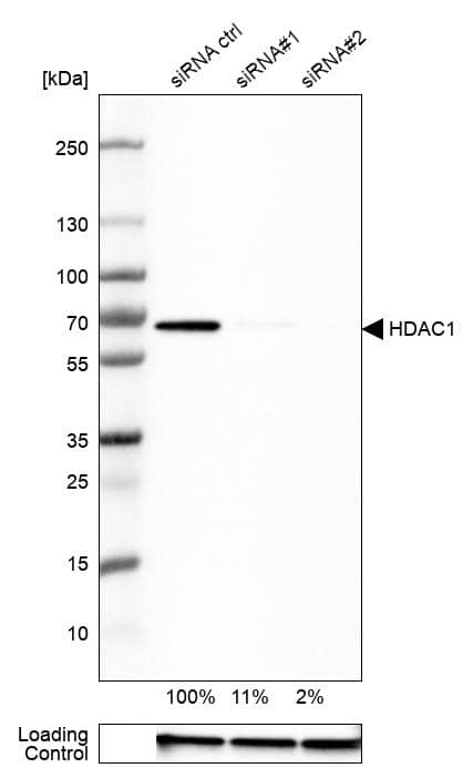 <b>Genetic Strategies Validation. </b>Analysis in RT-4 cells) transfected with control siRNA, target specific siRNA probe #1 and #2, using Anti-HDAC1 antibody. Remaining relative intensity is presented. Loading control: Anti-GAPDH.