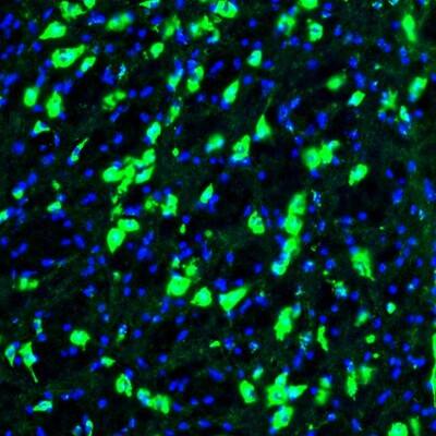 Staining of mouse globus pallidus shows positivity in neuronal cell bodies.