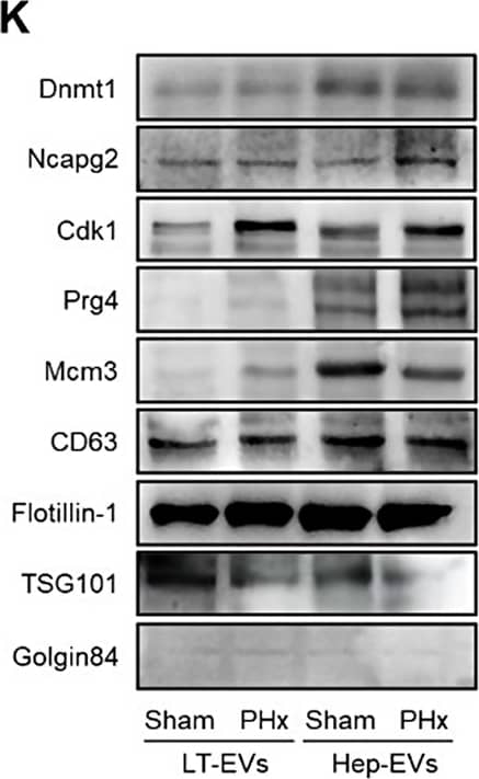Hep-EVs reveals enhanced release with proliferative information during liver regeneration. (A) Flow cytometric analysis showing ASGPR surface expression on LT-EVs before and after immunomagnetic sorting. (B) Size distribution of LT-EVs analyzed by NTA. (C) Quantification of particle number of LT-EVs by NTA and protein amount of LT-EVs determined by the BCA assay. Mean +/- SD. n = 3 per group. *, p < 0.05; ***, p < 0.001; one-way ANOVA with Turkey’s post-hoc tests. (D) Representative TEM image of LT-EVs from Sham and PHx livers. Bars = 250 nm. (E) Size distribution of sorted Hep-EVs analyzed by NTA. (F) Quantification of particle number of sorted Hep-EVs by NTA and protein amount determined by the BCA assay. Mean +/- SD. n = 3 per group. ***, p < 0.001; ****, p < 0.0001; one-way ANOVA with Turkey’s post-hoc tests. (G) Venn diagram of proteome of PHx and Sham Hep-EVs. (H) Volcano plot of proteome of PHx and Sham Hep-EVs. (I) GO terms in the Cellular Component category of DEPs enriched in PHx over Sham Hep-EVs. (J) Western blot analysis of protein marker expression of LT-EVs and Hep-EVs. (K) Top-ranked DEPs of interest in Hep-EVs and Western blot validation of expression Image collected and cropped by CiteAb from the following open publication (//jnanobiotechnology.biomedcentral.com/articles/10.1186/s12951-024-02790-0), licensed under a CC-BY license. Not internally tested by Novus Biologicals.