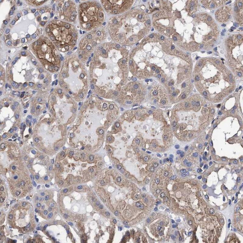 Staining of human kidney shows weak granular cytoplasmic positivity in cells in tubules.
