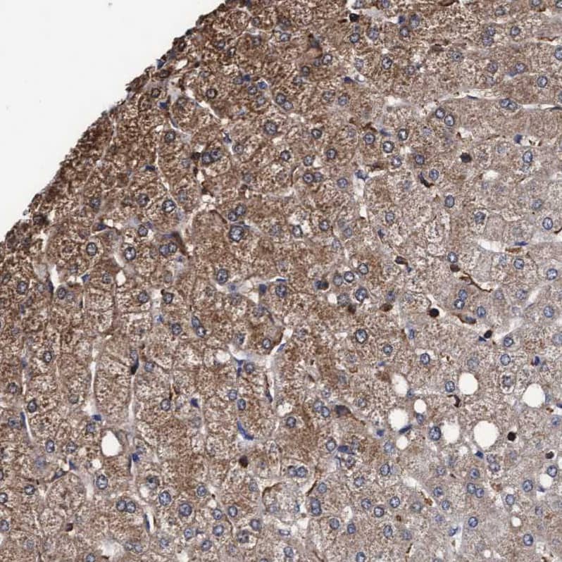 Staining of human liver shows moderate granular cytoplasmic positivity in hepatocytes.