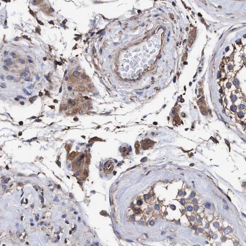Staining of human testis shows moderate cytoplasmic positivity in Leydig cells.