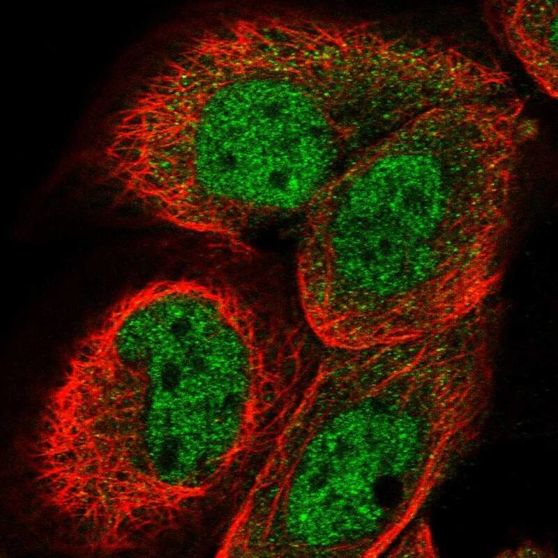 Staining of human cell line A-431 shows localization to nucleoplasm.