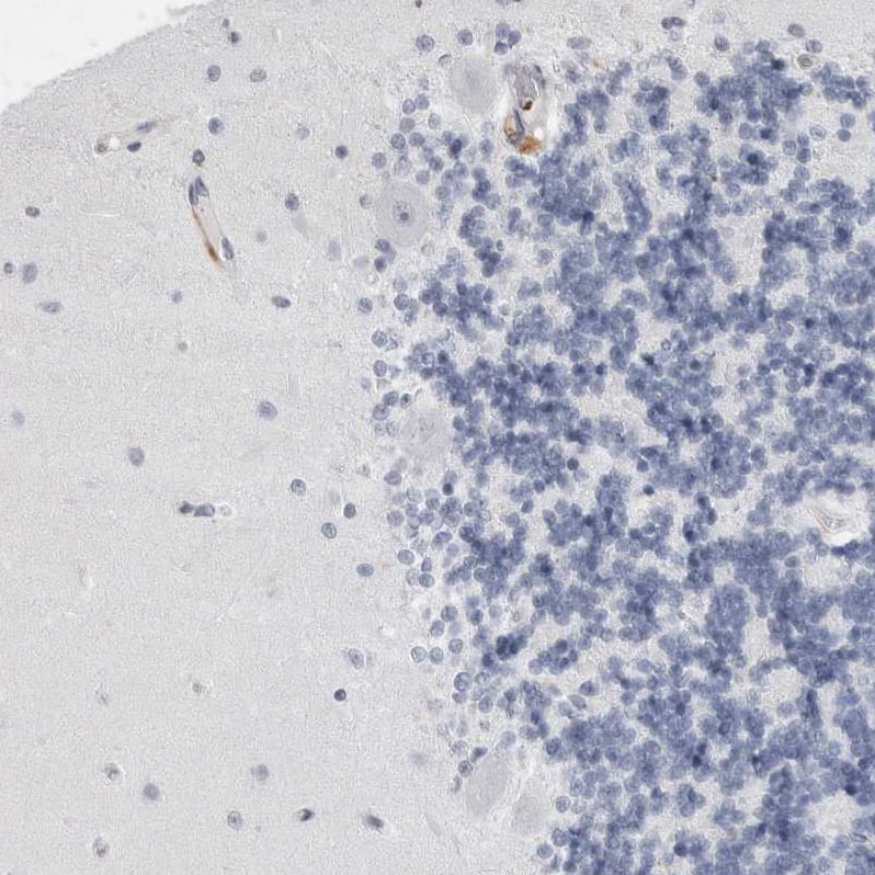 Immunohistochemistry-Paraffin GILT/IFI30 Antibody - BSA Free