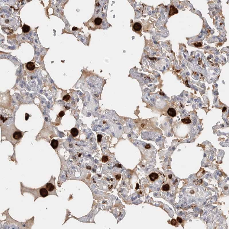 Immunohistochemistry-Paraffin GILT/IFI30 Antibody - BSA Free