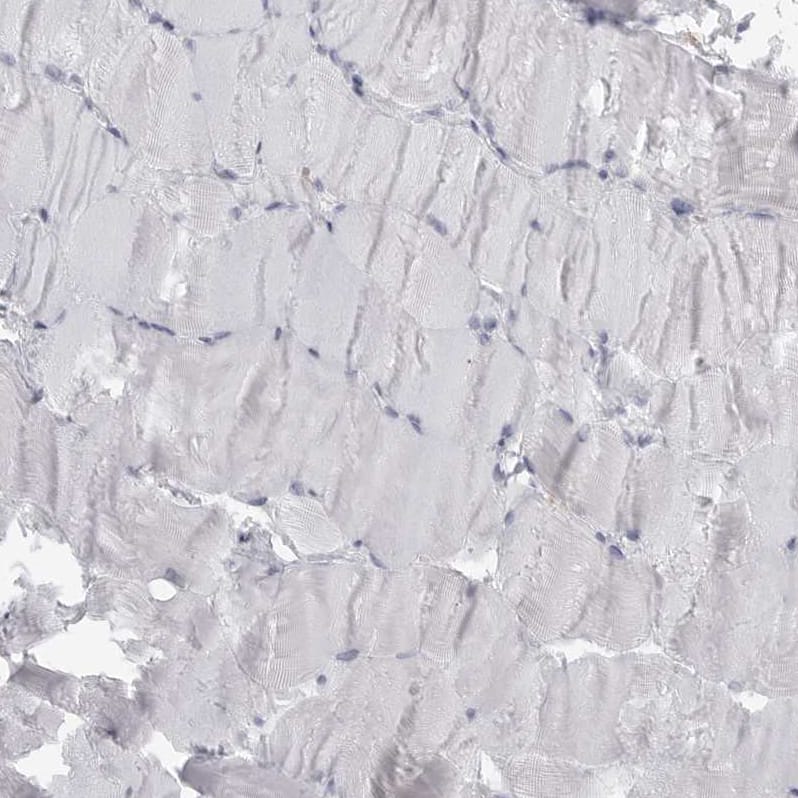 Immunohistochemistry-Paraffin GILT/IFI30 Antibody - BSA Free