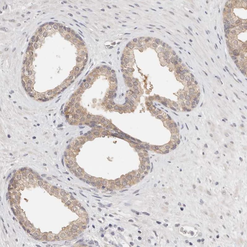 Staining of human prostate shows moderate cytoplasmic positivity in glandular cells.