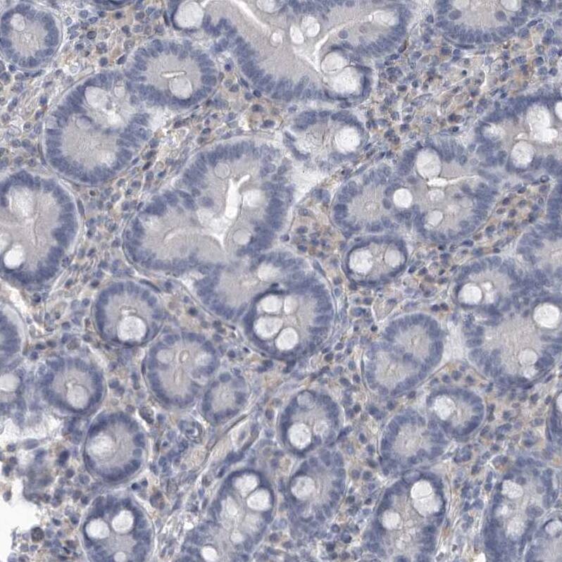 Immunohistochemistry-Paraffin ARHGEF10 Antibody - BSA Free
