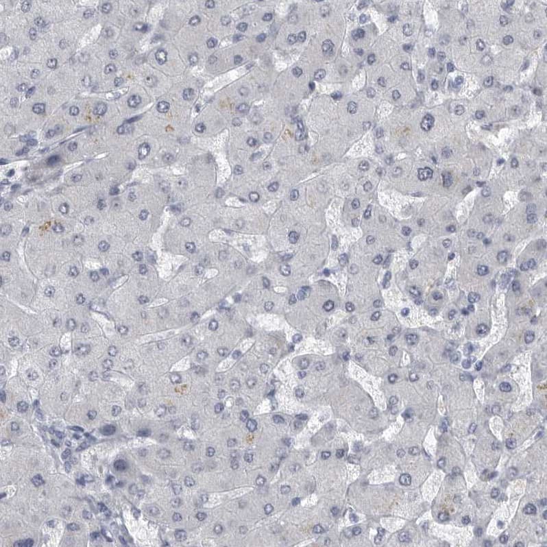 Immunohistochemistry-Paraffin ARHGEF10 Antibody - BSA Free