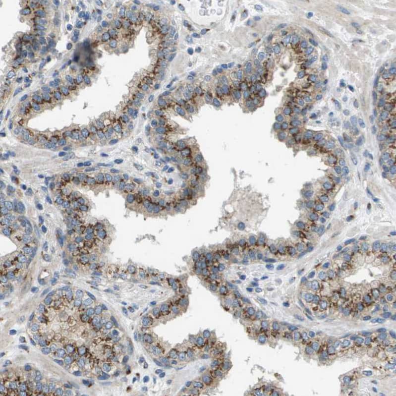 Staining of human prostate shows strong granular cytoplasmic positivity in glandular cells.