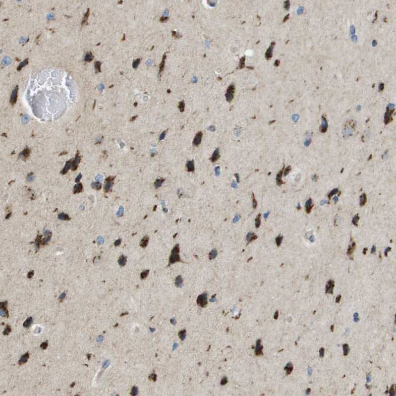 Staining of human cerebral cortex shows strong granular cytoplasmic positivity in neurons.