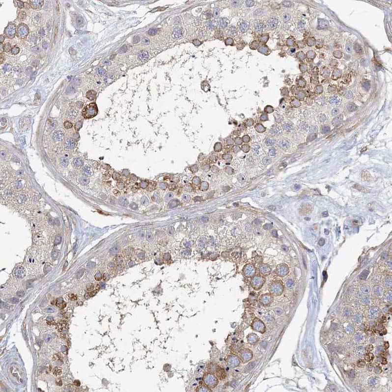 Staining of human testis shows moderate cytoplasmic positivity in cells in seminiferous ducts.