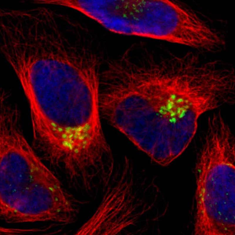 Immunocytochemistry/ Immunofluorescence GALNT2 Antibody - BSA Free