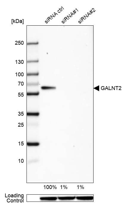 Analysis in HeLa cells) transfected with control siRNA, target specific siRNA probe #1 and #2, using Anti-GALNT2 antibody. Remaining relative intensity is presented. Loading control: Anti-GAPDH.