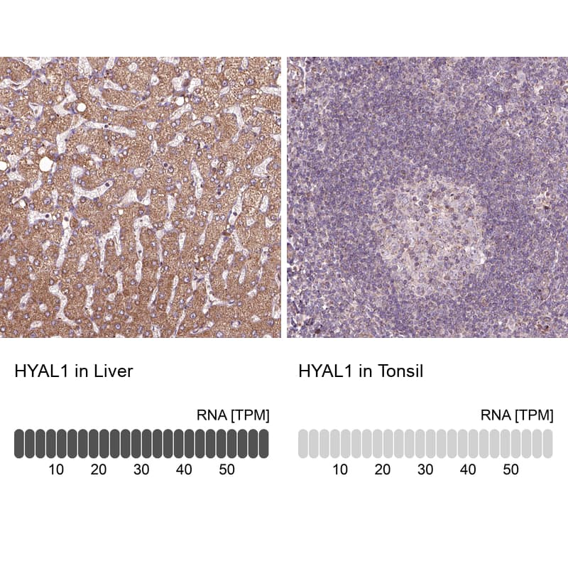 <b>Orthogonal Strategies Validation. </b>Analysis in human liver and tonsil tissues using NBP1-83409 antibody. Corresponding HYAL1 RNA-seq data are presented for the same tissues.