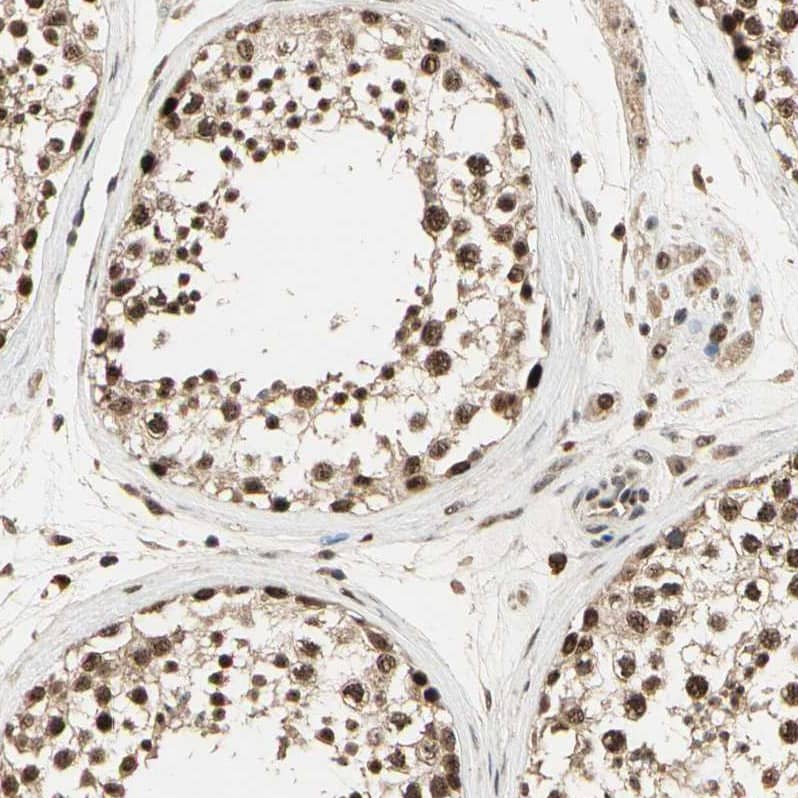 Staining of human testis shows strong nuclear positivity in cells in seminiferous ducts.