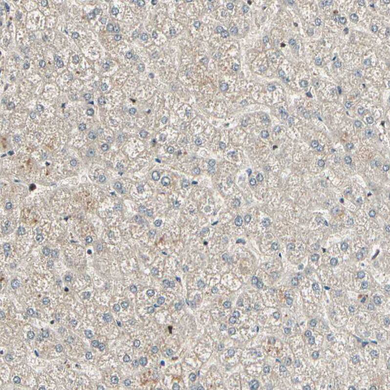 Staining of human liver shows no positivity in hepatocytes as expected.
