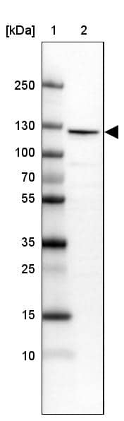 Lane 1: Marker [kDa] 250, 130, 100, 70, 55, 35, 25, 15, 10Lane 2: Human cell line MOLT-4