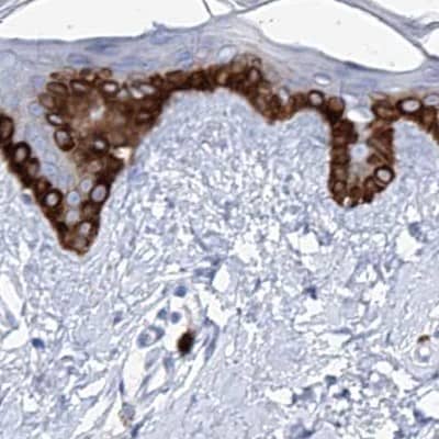 Immunohistochemistry-Paraffin FRS3 Antibody - BSA Free