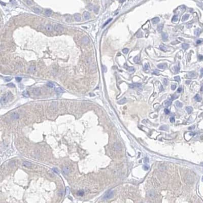 Immunohistochemistry-Paraffin FRS3 Antibody - BSA Free
