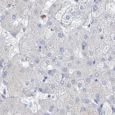 Immunohistochemistry-Paraffin FRS3 Antibody - BSA Free