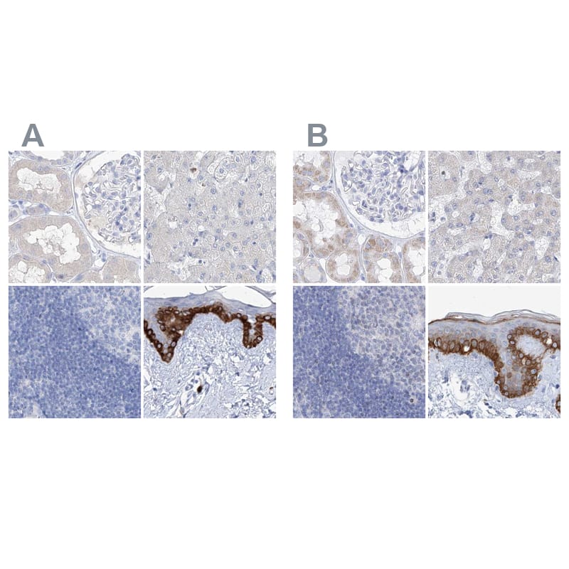 Immunohistochemistry-Paraffin FRS3 Antibody - BSA Free