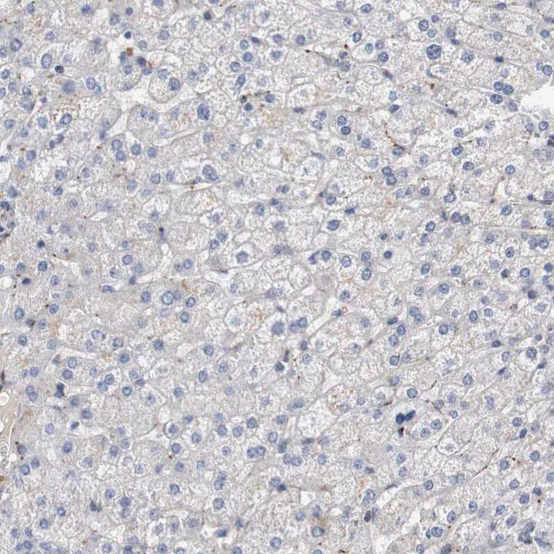 Staining of human liver shows no positivity in hepatocytes as expected.