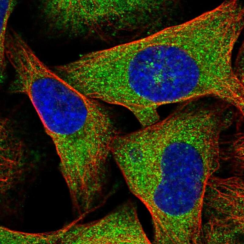 Staining of human cell line U-2 OS shows localization to cytosol & vesicles.