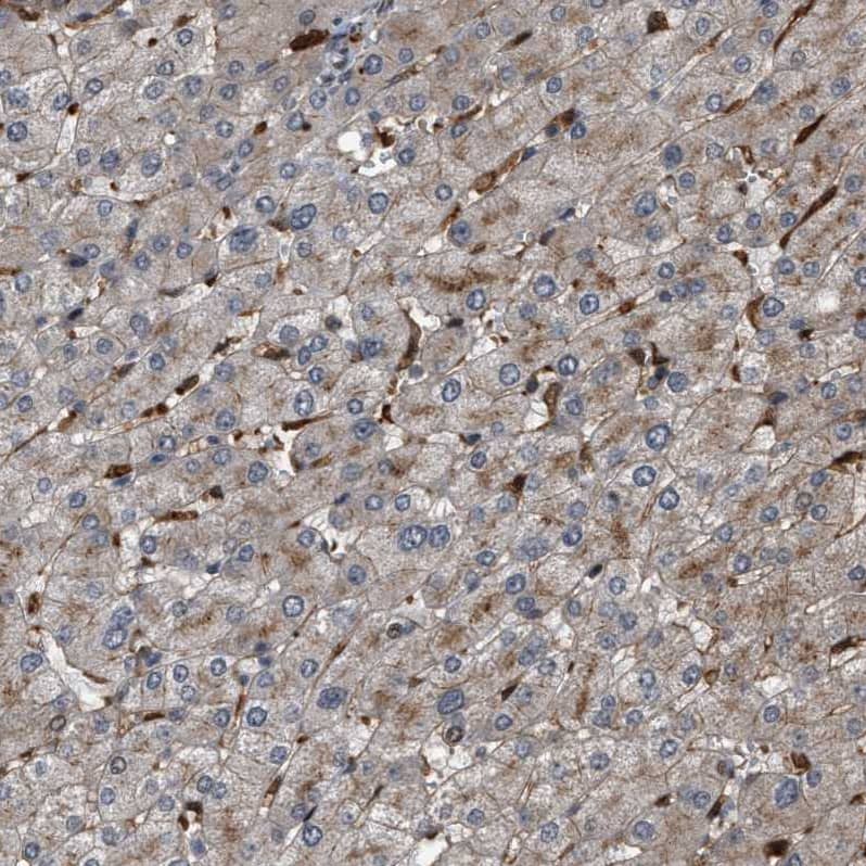 Staining of human liver shows moderate membranous and cytoplasmic positivity in hepatocytes.