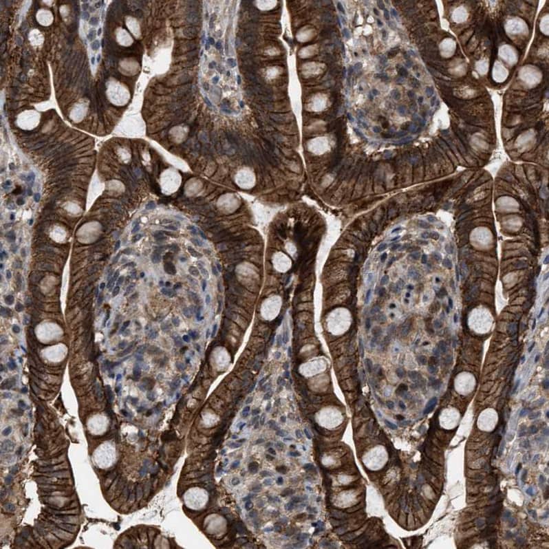 Staining of human small intestine shows strong membranous and cytoplasmic positivity in glandular cells).